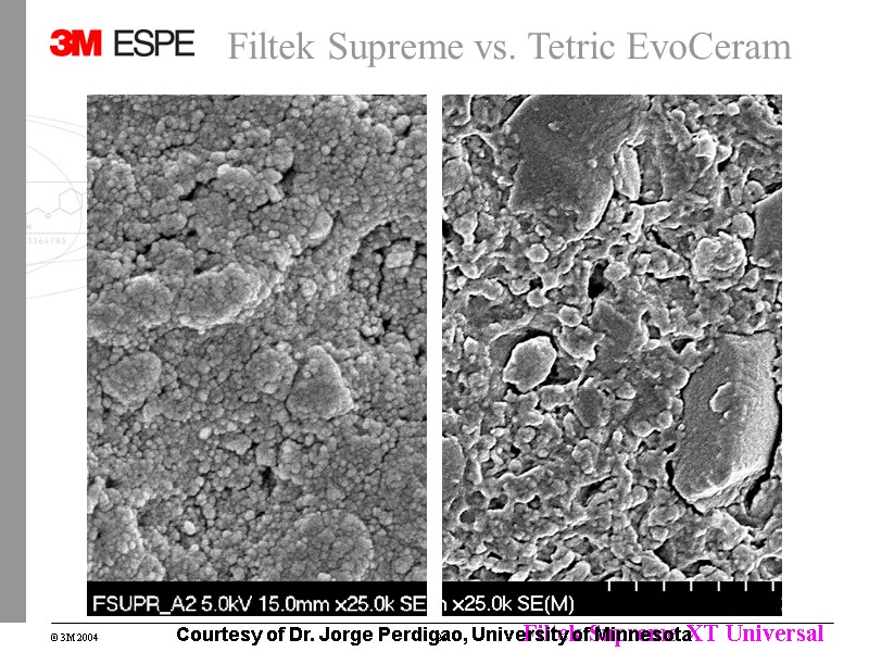 Filtek Supreme vs. Tetric EvoCeram Courtesy of Dr. Jorge Perdigao, University of Minnesota Filtek Supreme vs. Tetric EvoCeram Courtesy of Dr. Jorge Perdigao, University of Minnesota